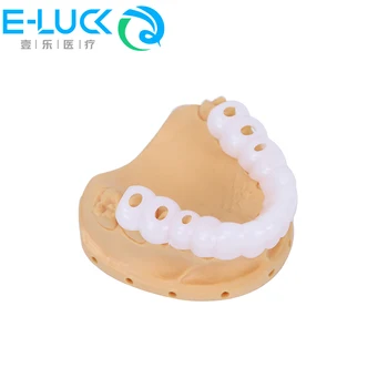 Протези за моделиране на зъби, избелване на зъби, скоби за горните и долните зъби